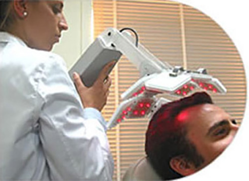 Laser Hair Loss Treatment